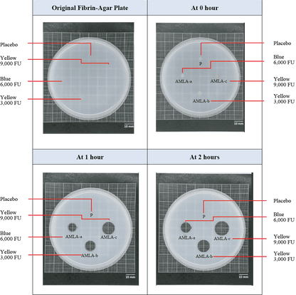 Vegan Nattokinase - Advanced Circulatory Support